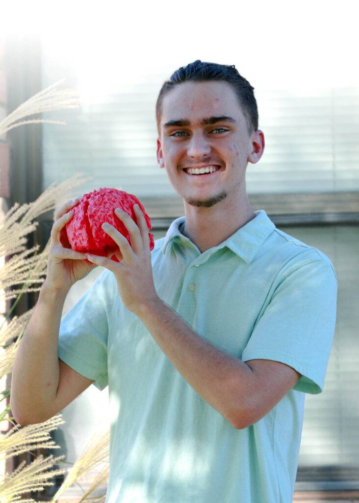 A teen holds a 3D printed model of his brain.